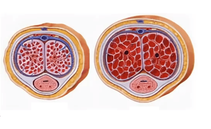 lipofilling per l'ingrandimento del pene