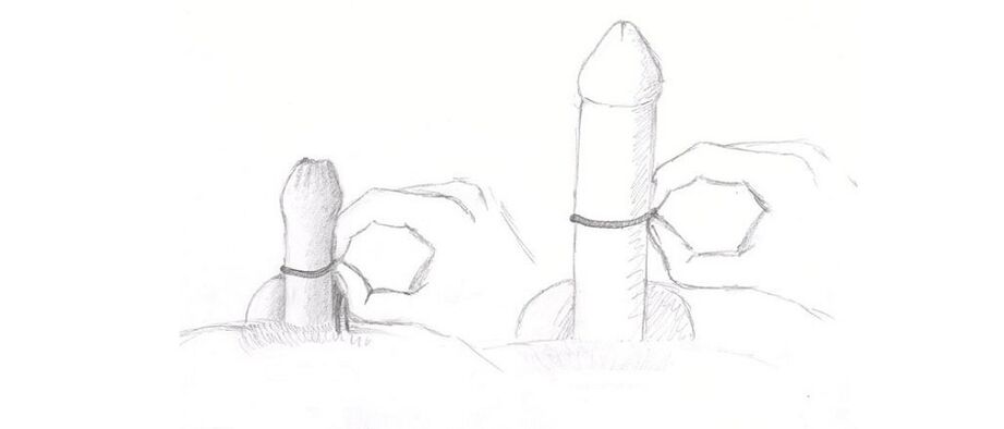 misurazione dello spessore del pene